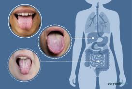 What Your Tongue Says About Your Health